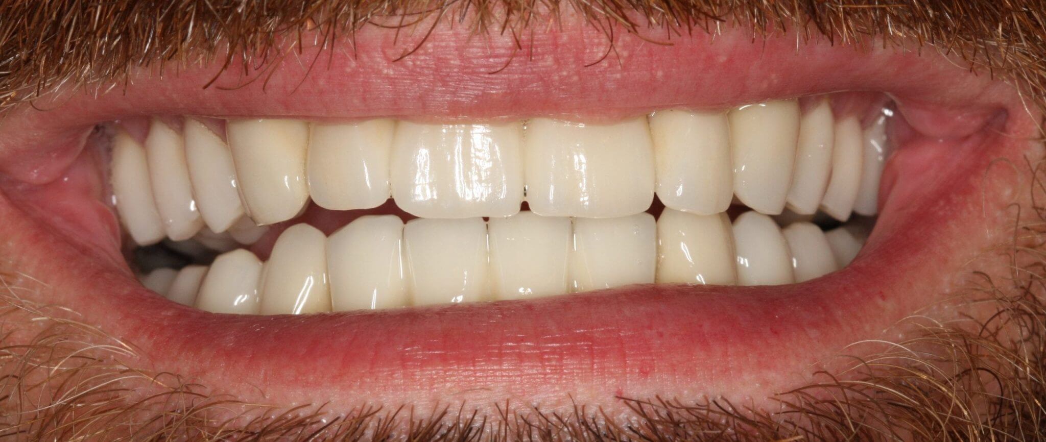 imgi 11 IMG 9020 Zuschnitt Header