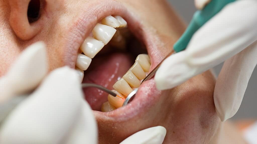 Laserbehandlung 3 OLZE Leistung Laserbehandlung Zielgerichtet 1