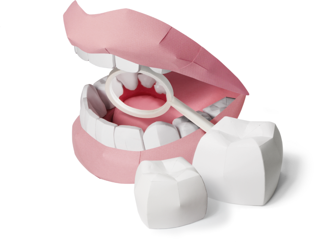 Ästhetische Zahnheilkunde 3 Zahnaufhellung & Bleaching