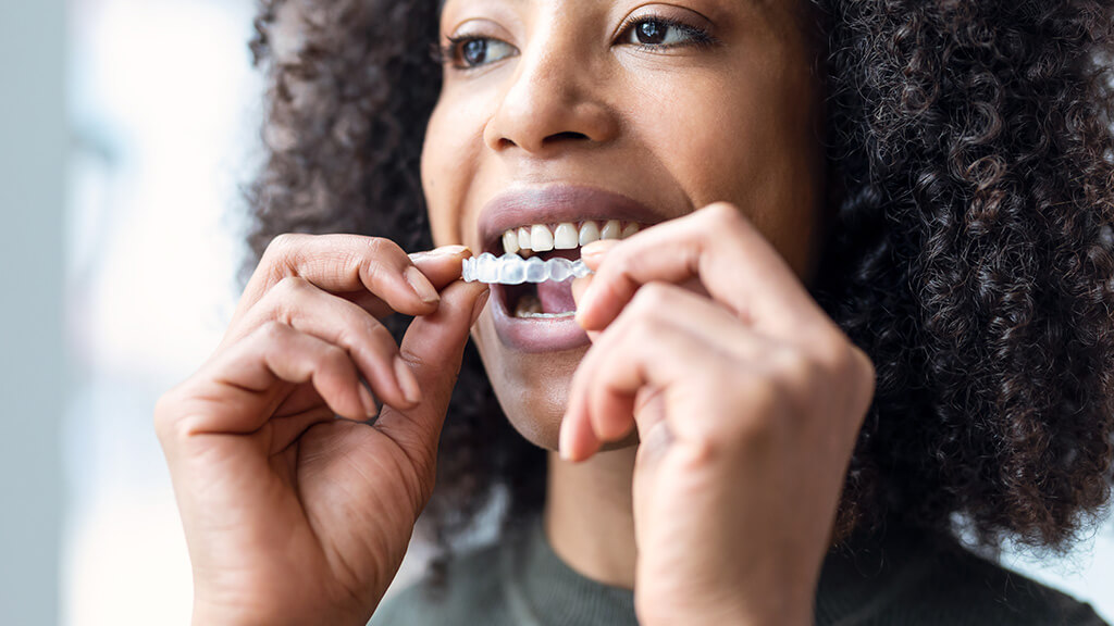 Bisshebung mit Vollkeramik 4 OLZE Fachartikel Bisshebung Vollkeramik Therapie