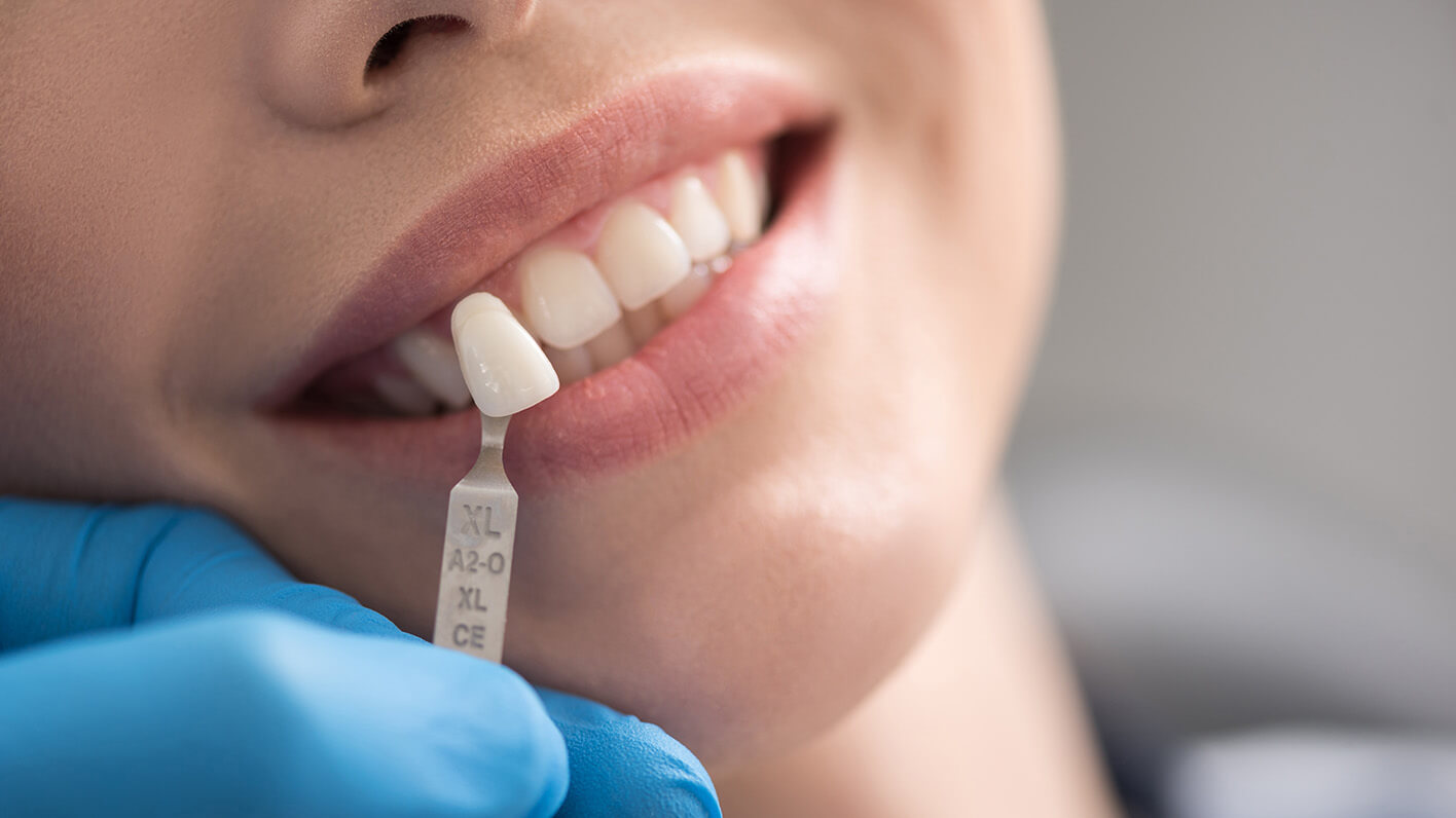 Bisshebung 1 OLZE Fachartikel Bisshebung Header