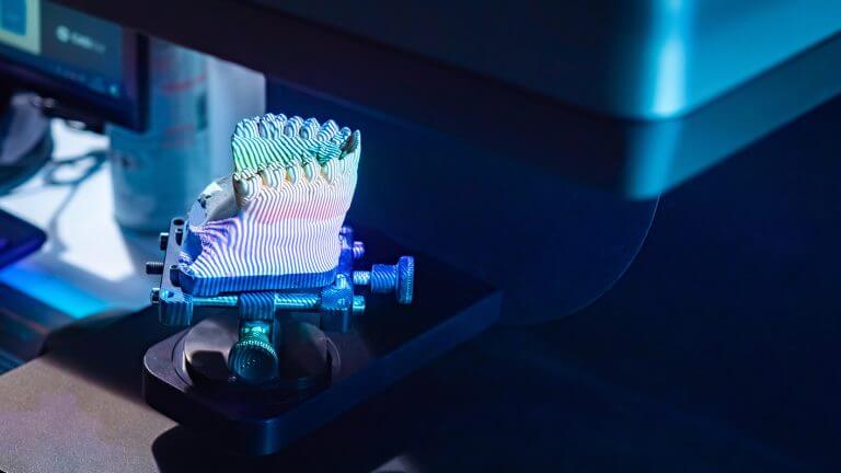 3D-Druck eines zahnmedizinischen Modells