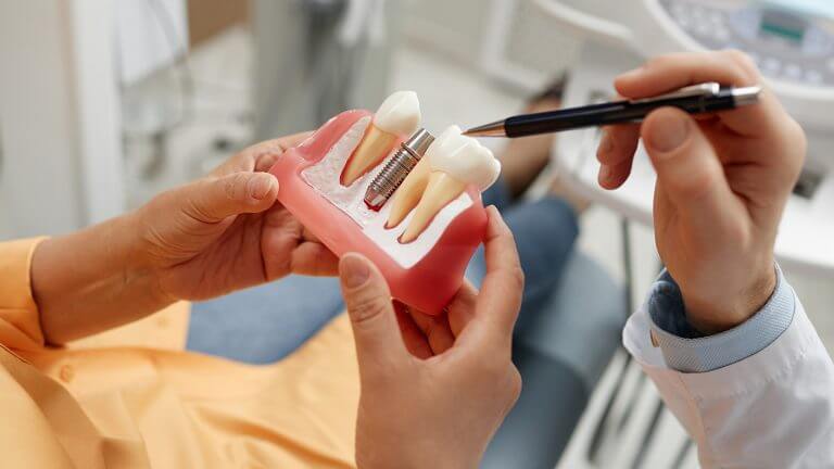 Leistungen 10 Zahnimplantate