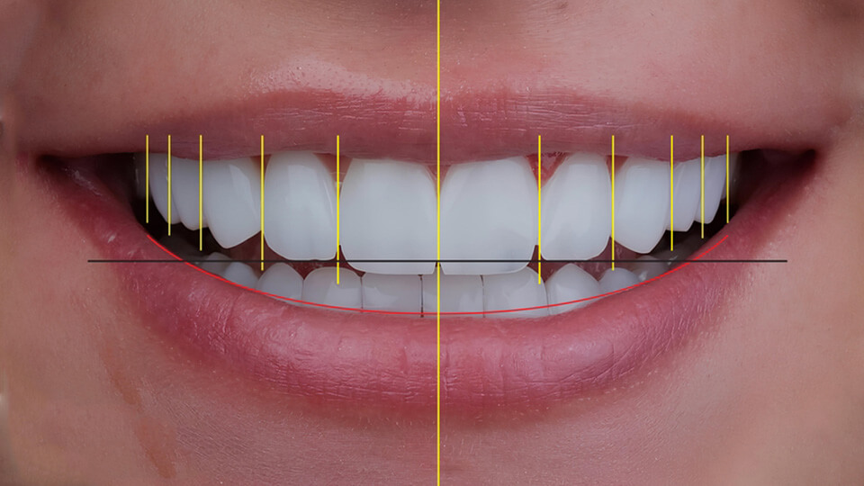 OLZE Fachartikel Digital Smile Design