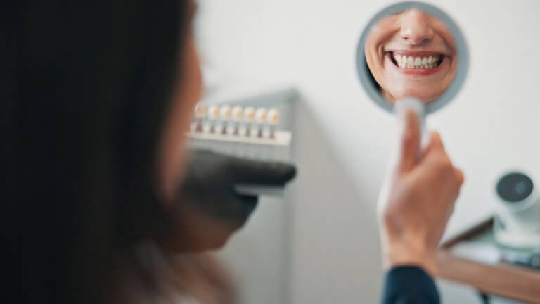 Veneers werden on einer Frau im Spiegel betrachtet