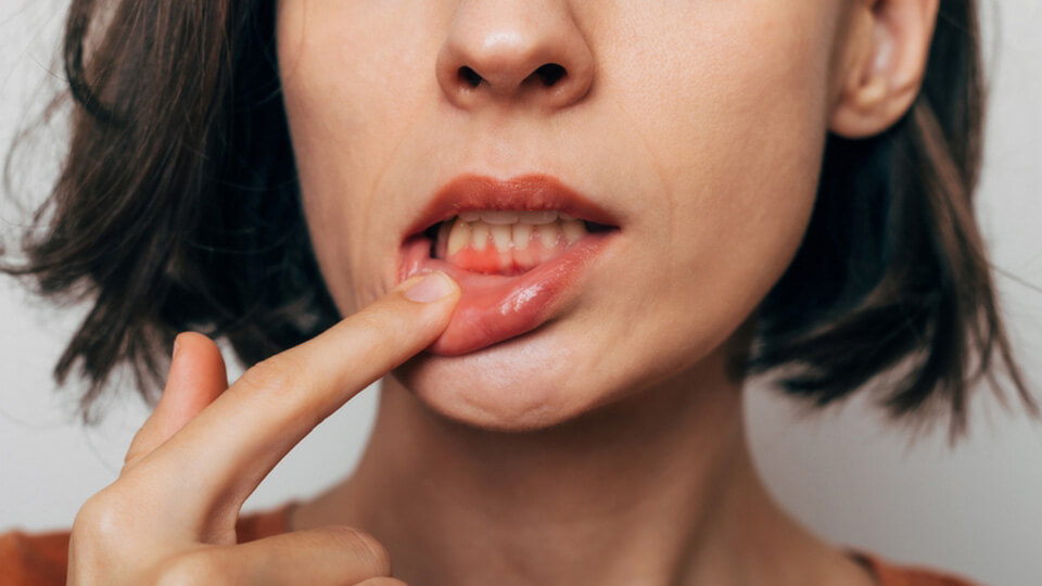 OLZE Fachartikel Schaedlicher Biofilm 03