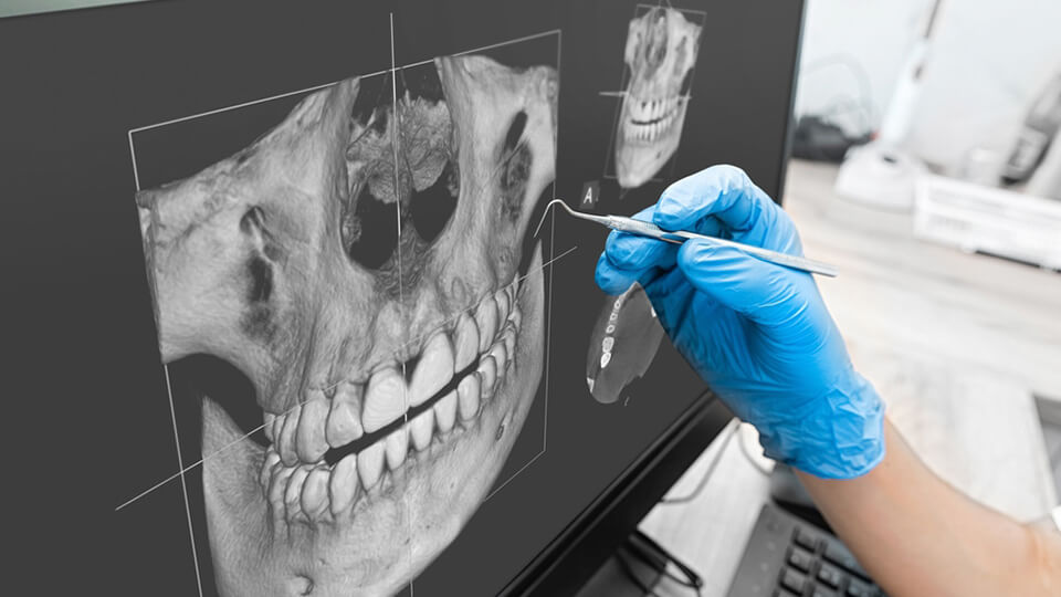 OLZE Fachartikel Knochenaufbau 02