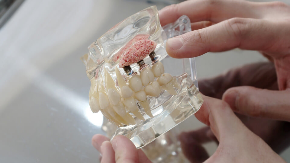 OLZE Fachartikel Knochenaufbau 04