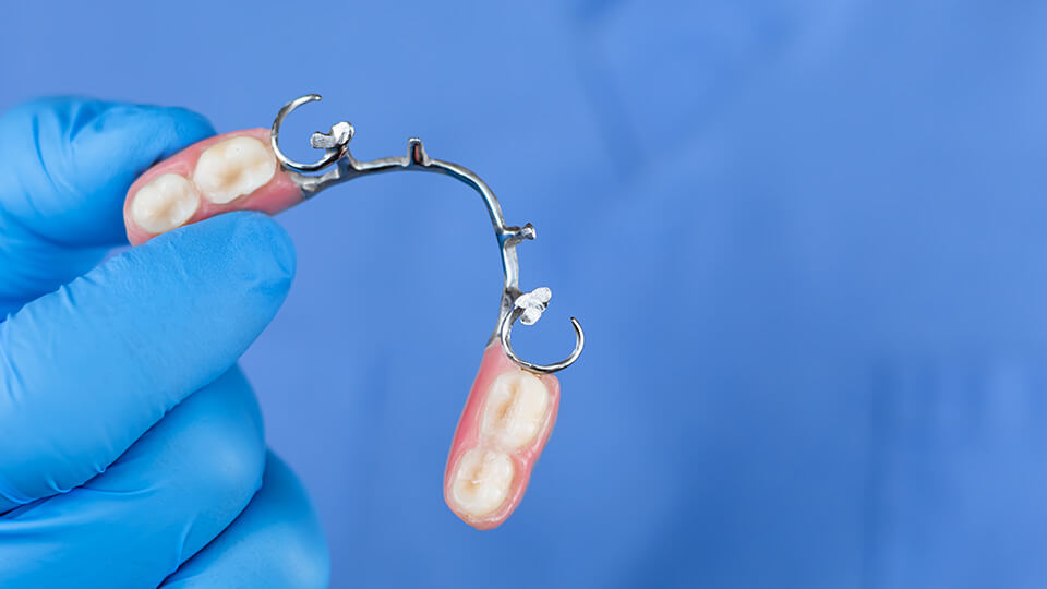 OLZE Fachartikel Zahnersatztypen 02