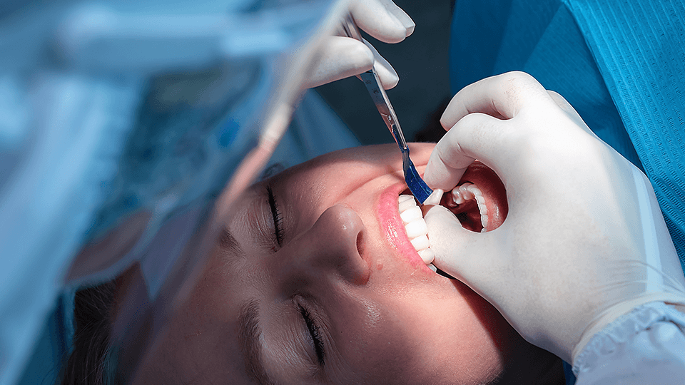 OLZE Fachartikel Zahnkrone 01