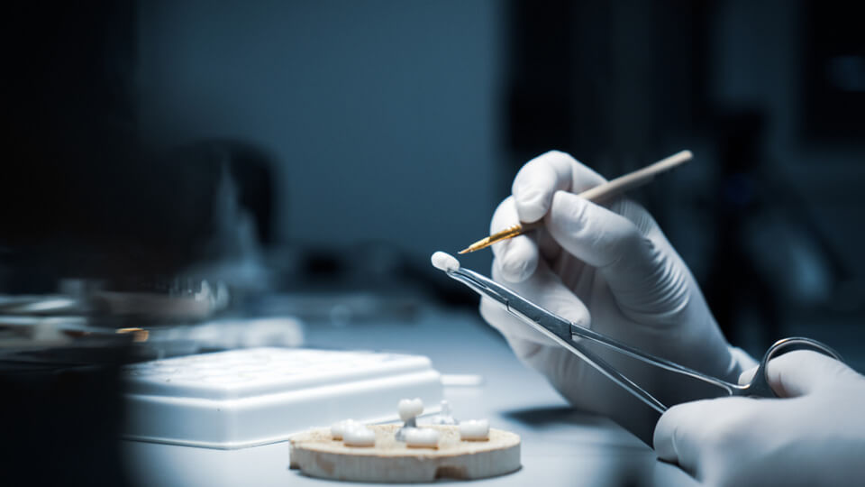 OLZE Fachartikel Zahnkrone 04